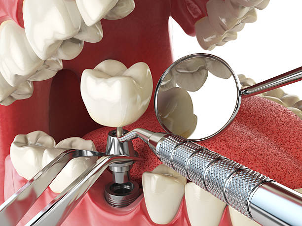 Best After-Hours Emergency Dentist in Meridian Village, CO