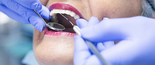 Best Emergency Tooth Extraction in Meridian Village, CO